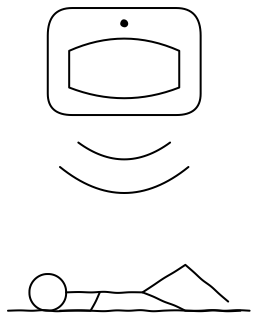 Fall detection sensor from the aged-care shape library