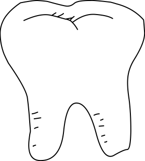 Tooth from the Medical shape library